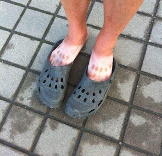 Точечный загар