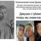 Лице-анусы pic
