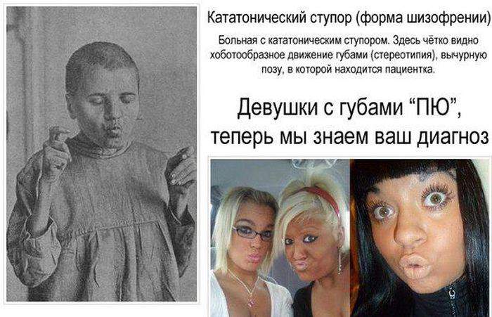 Лице-анусы